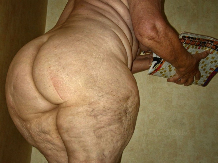 Голые целюлитные женщины