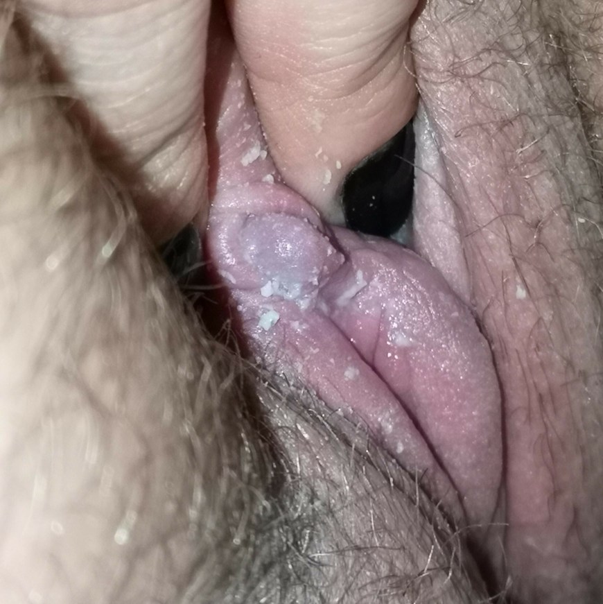 Unwashed pussy has Major smegma discharge