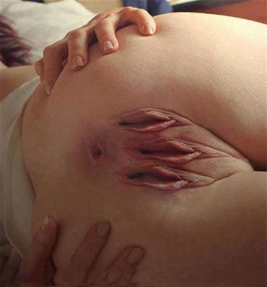 Девушка у которой две вагины