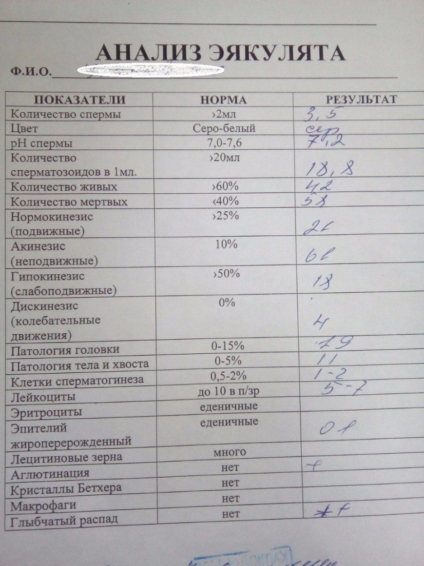 Анализ эякулята норма
