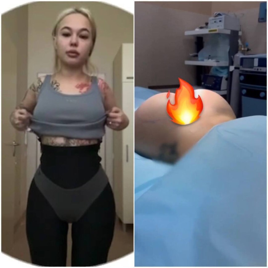 Instasamka до операций